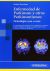 ENFERMEDAD DE PARKINSON Y OTROS PARKINSONISMOS: NEUROLOGIA CASO A CASO