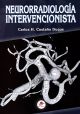 Neurorradiología Intervencionista